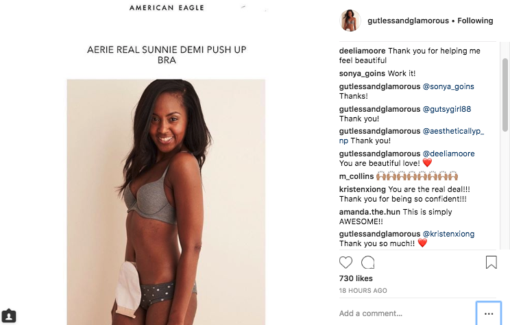 Aerie not only refuses to retouch any of their photos, but they're truly  inclusive with their models. their latest line features a model with a  colostomy bag. : r/Instagramreality