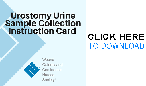 Urostomy Urine Sample Collection Instruction Card