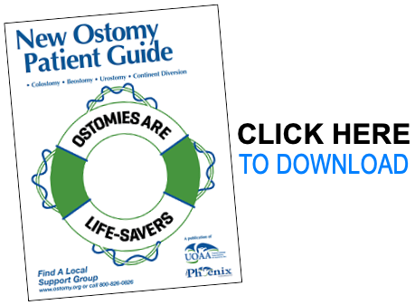 Know Your Ostomy Pouching System & Supplies - United Ostomy