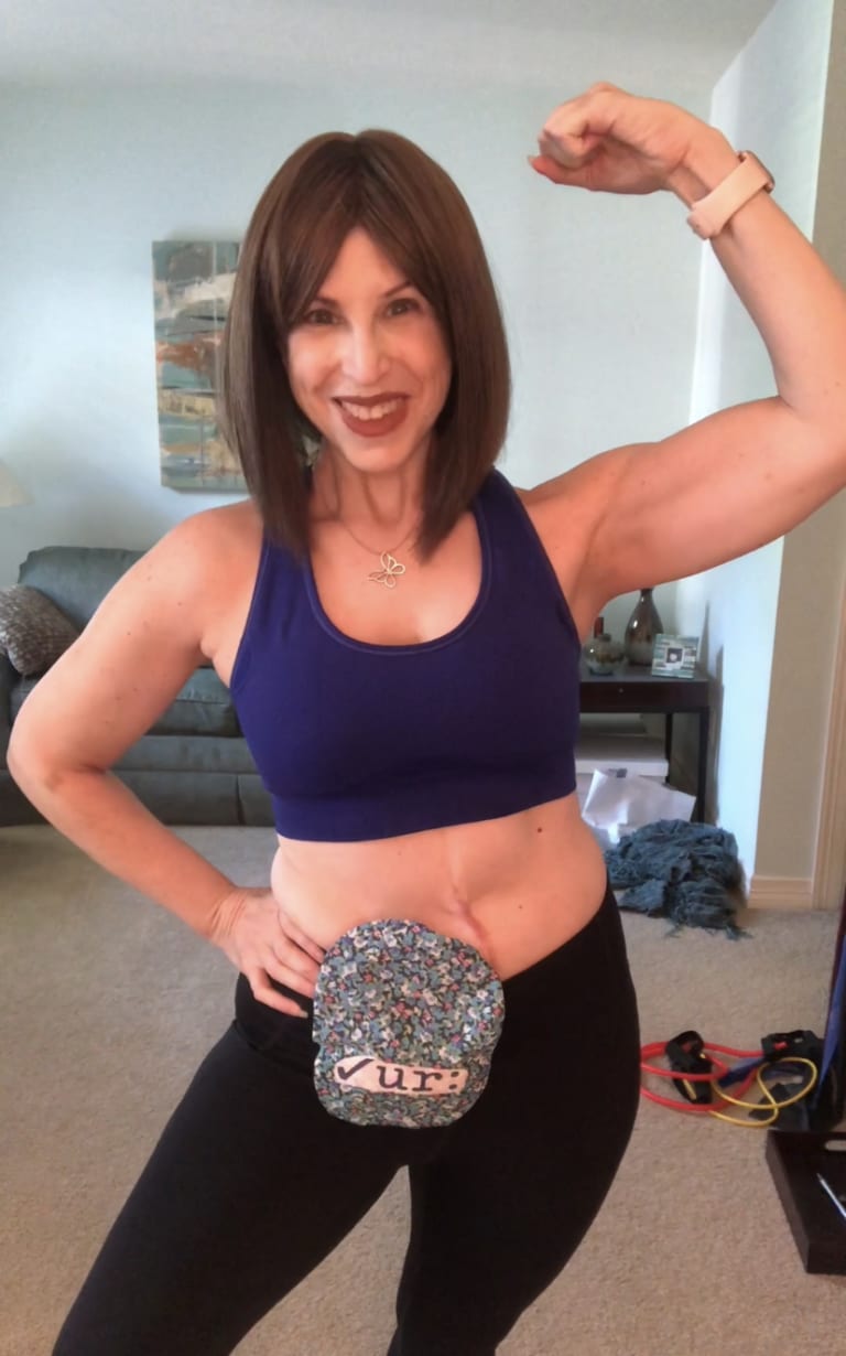 Allison Rosen's Story Me, Myself and Fill United Ostomy Associations