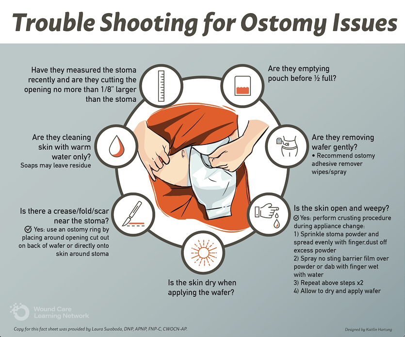 Trouble Shooting for Ostomy Issues - Copyright 2021. Wound Care Learning Network