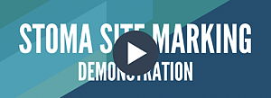 Stoma Site Marking Demo Video
