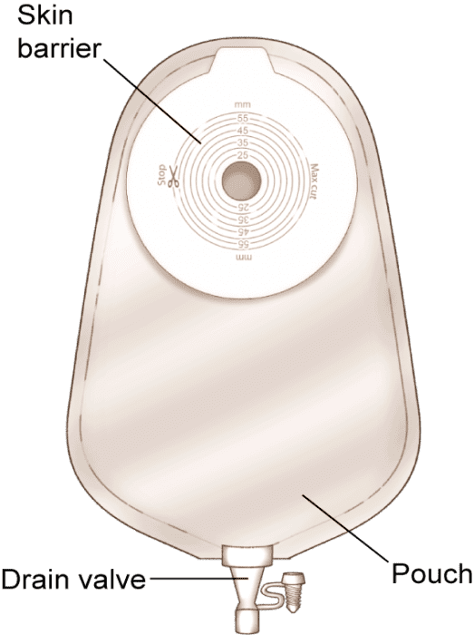 Types of Pouching Systems l United Ostomy Association Of America