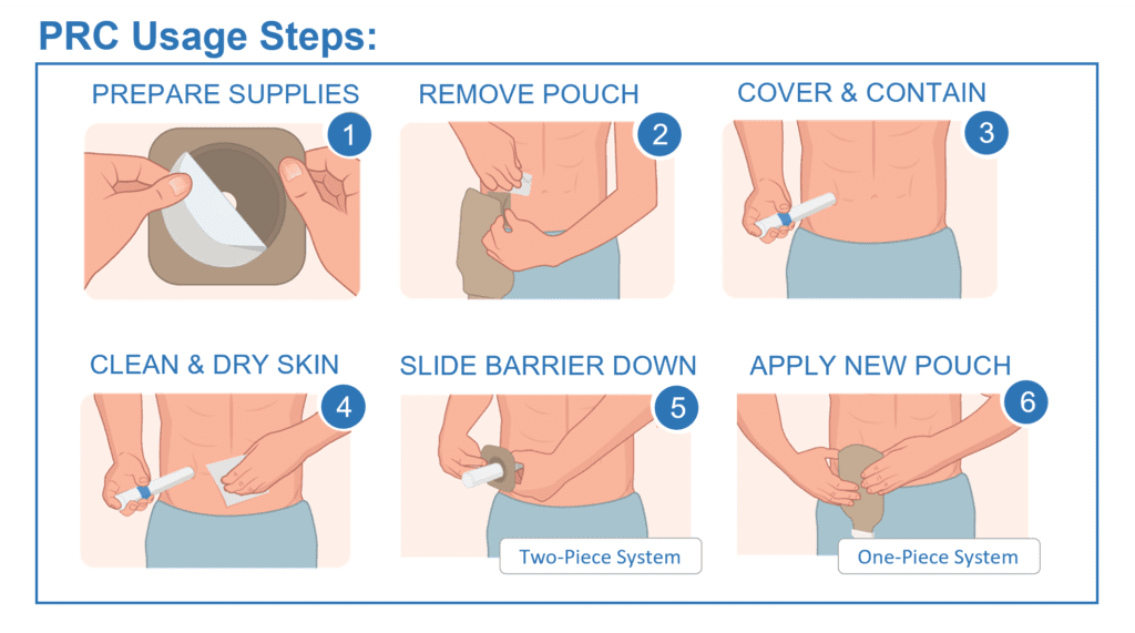 Premier Ostomy Pouch Drainable up to 2.5