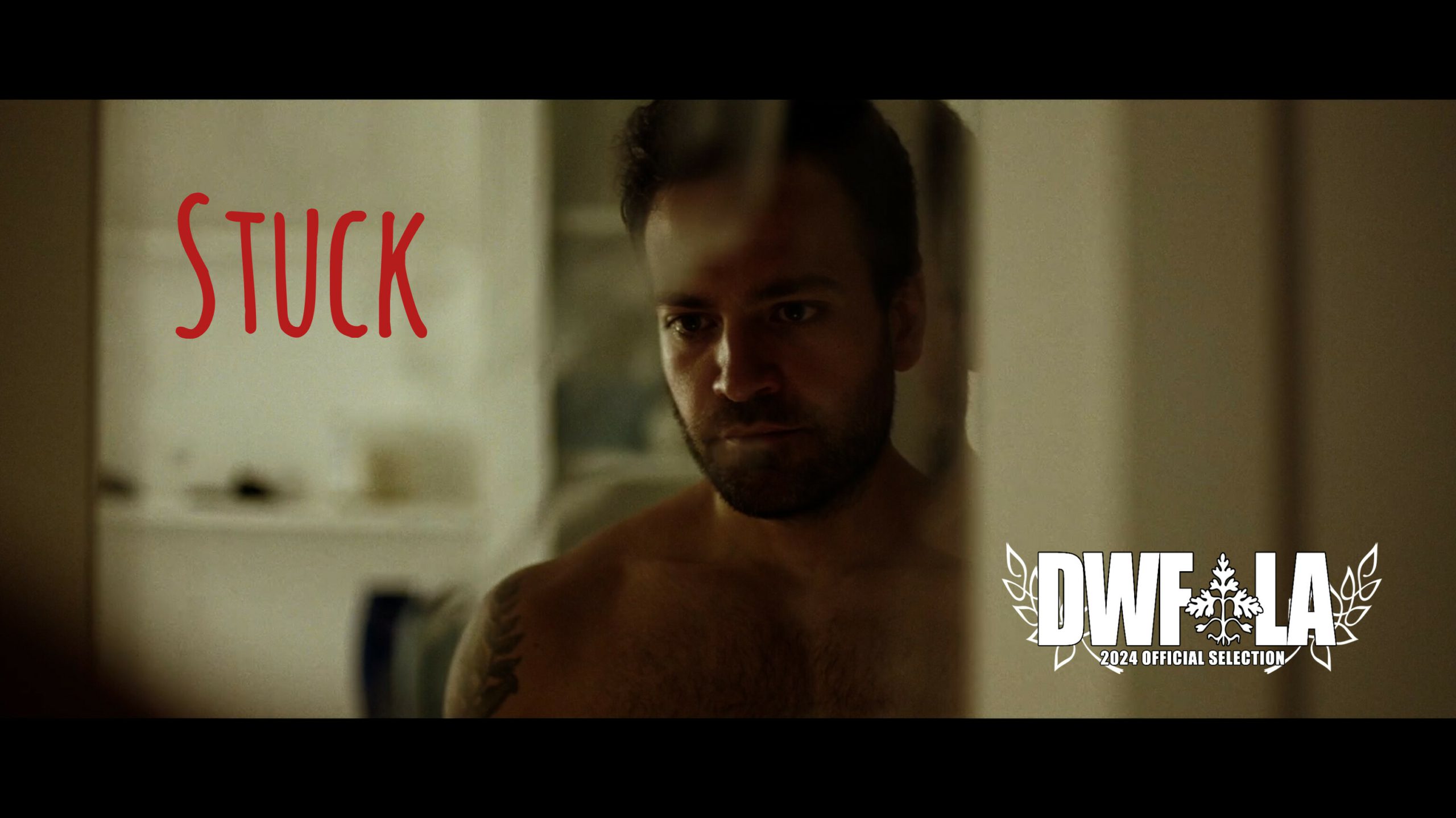 From the Stage...to Ostomy Surgery...To the Big Screen - United Ostomy  Associations of America