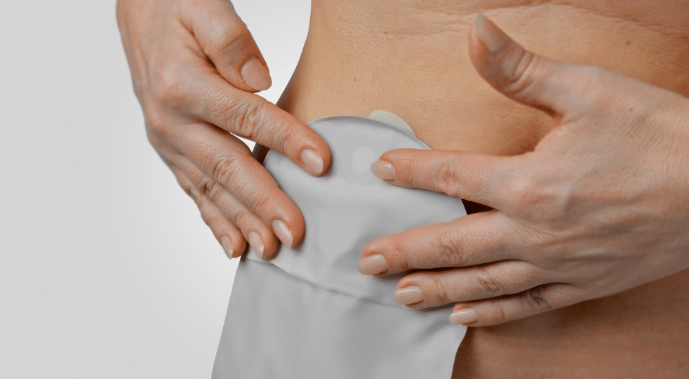 Photo - Why Do Some People with Ostomies Name Their Stoma - Coloplast
