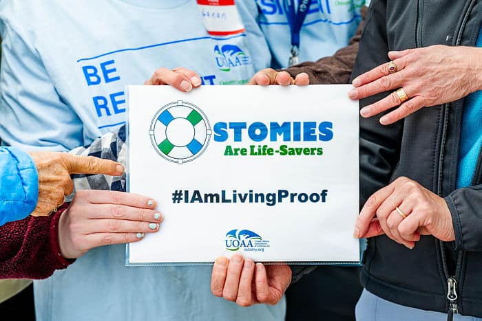 Ostomies are Live-Savers I Am Living Proof