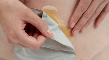 Photo – Why does my ostomy pouch keep leaking